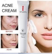 Крем від прищів та акне на рослинній основі Venzen acne crem 20 мл 030401 фото