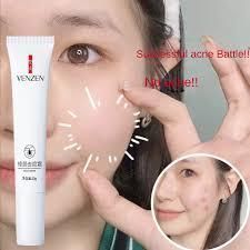 Крем від прищів та акне на рослинній основі Venzen acne crem 20 мл 030401 фото