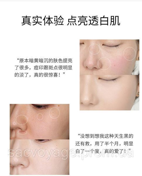 Крем від прищів та акне на рослинній основі Venzen acne crem 20 мл 030401 фото