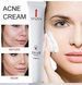 Крем від прищів та акне на рослинній основі Venzen acne crem 20 мл 030401 фото 8