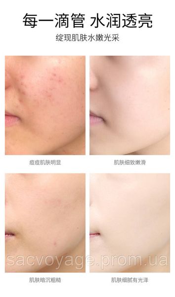 Акция! Набор Images Niacinamide с никотиномидом пенка для умывания 60мл + сыворотка регенерирующая 30мл 06020110 фото