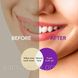 Зубной гель Hismile v34 Color Corrector фиолетовое средство для осветления и отбеливания зубов 30мл 0150103 фото 4