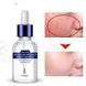 Сыворотка для лица Rorec Hydra B5 Essence с экстрактом гиалуроновой кислоты и витамином B5 15мл 020209 фото 1