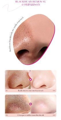 Очищающая полоска для удаления черных точек Sadoer bamboo charcoal gentle с бамбуковым углем 1шт. 0104002 фото