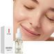 Есенція для обличчя від акне ETAE WHITENING ANTI-BLEMISH ESSENCE 15 мл 0202065 фото 2