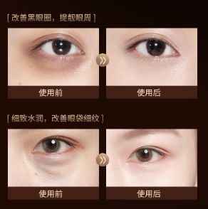 Крем для повік з ікрою та аллантоїном jomtam Retinol Caviar Eye Cream антівіковий 20мл 030803 фото