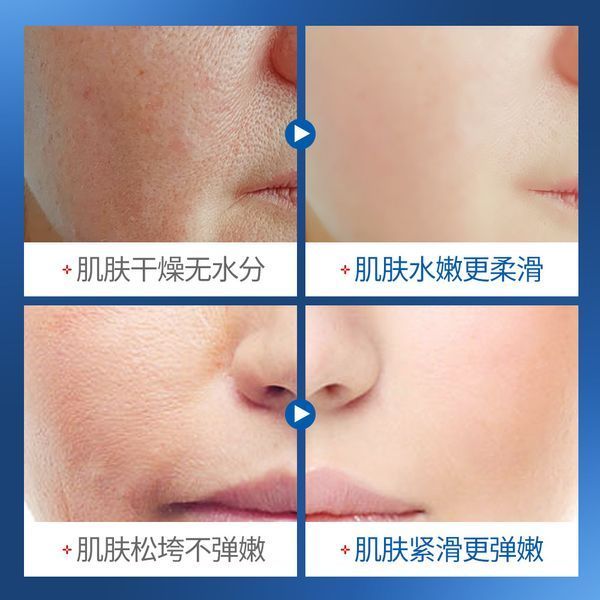 Увлажняющая сыворотка с гиалуроновой кислотой Sadoer Hyaluaronate Hydrat Moisturiz Serum 120мл 0202048 фото