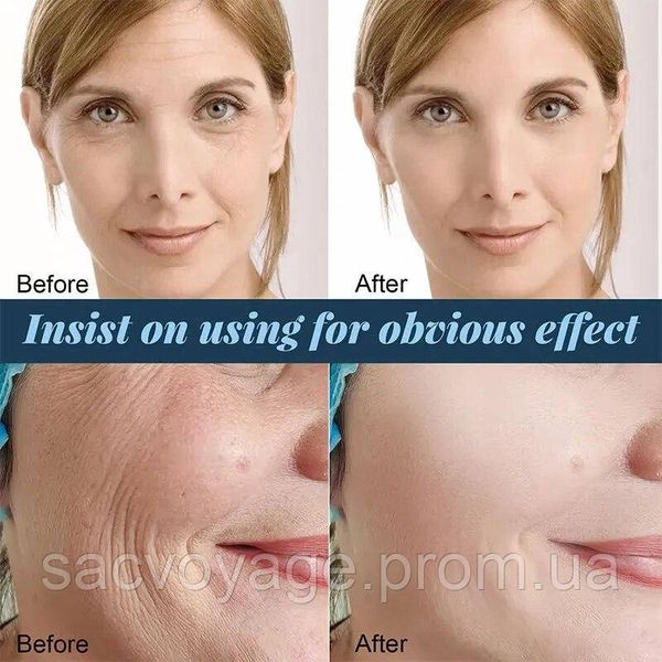 АКЦИЯ!!! Сыворотка антивозрастная Veze Anti-Wrinkle Essence + белковые коллагеновые нити Self от морщин 020306 фото