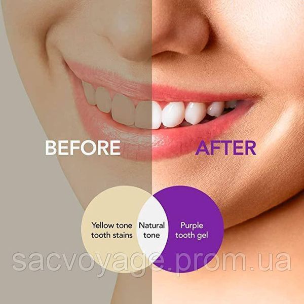 Відбілюючий зубний гель Hismile v34 Color Corrector фіолетовий засіб для освітлення та вибілювання зубів 30мл 0150103опт фото