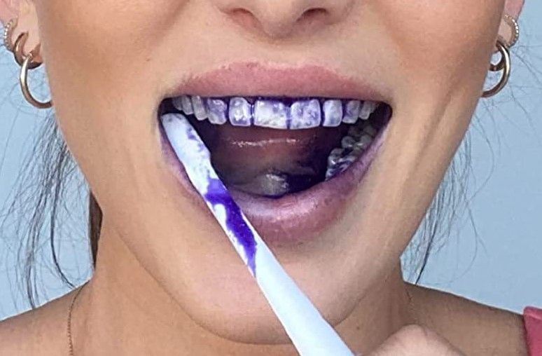 Відбілюючий зубний гель Hismile v34 Color Corrector фіолетовий засіб для освітлення та вибілювання зубів 30мл 0150103опт фото
