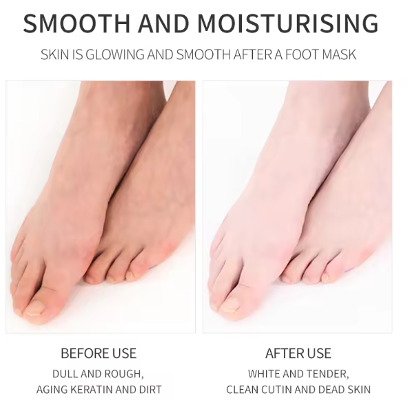 Шкарпетки для ніг FENGCARE goats milk mild exfoliating foot mask з ніацинамідом та козячим молоком 1 пара 010505 фото