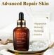 УЦЕНКА!!! Увлажняющая сыворотка для лица VEZE Niacinome Hydrating Moisturizing Essence с ниацинамидом 30 мл 0202031 фото 11
