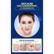 Тканевая маска для лица от прыщей и акне на растительной основе Hymey`s acne removing 25г 010208 фото 3