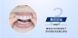 Смужки для відбілювання зубів 9D WHITE Teeth Whitening Strips від зубного нальоту 14 пар 0150202 фото 6